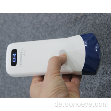 Sonostar am besten verkaufender drahtloser Ultraschallscanner